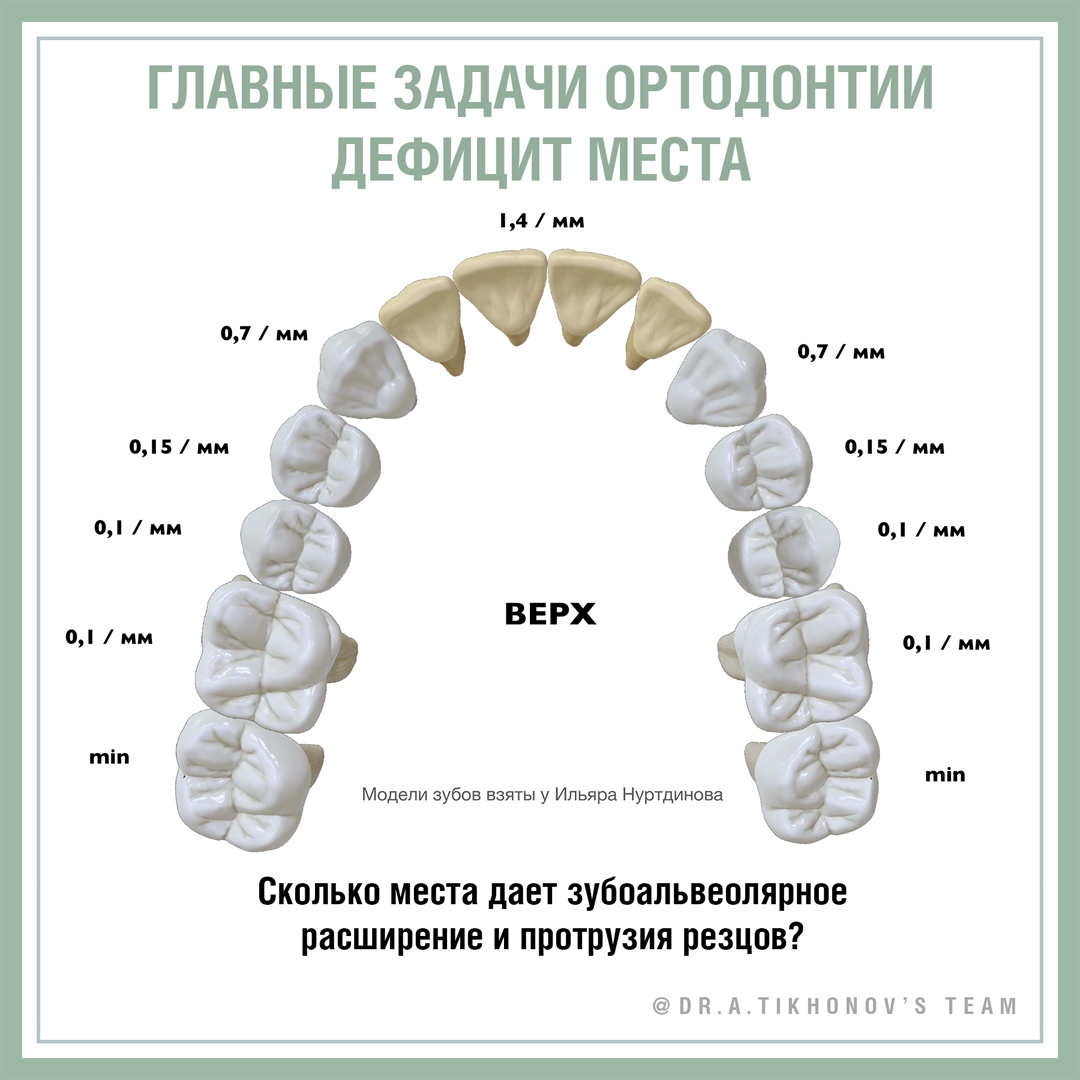 Главные задачи ортодонтии: дефицит места. - интересно об ортодонтии,  имплантации и протезировании зубов